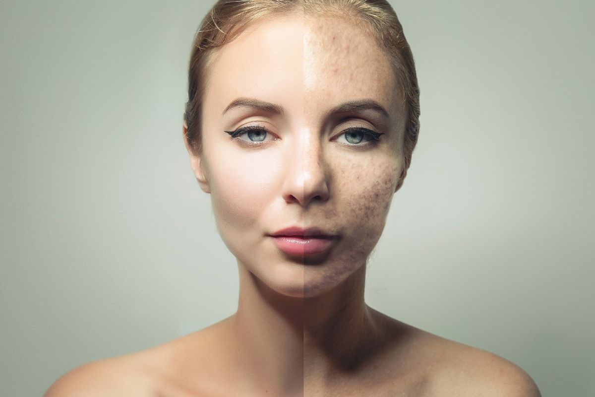 viso donna prima e dopo