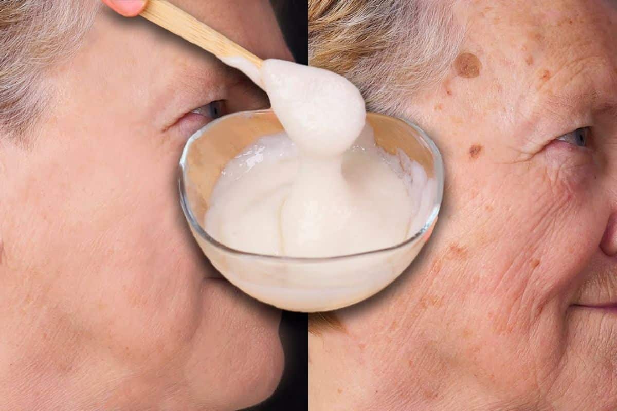 viso donna prima e dopo