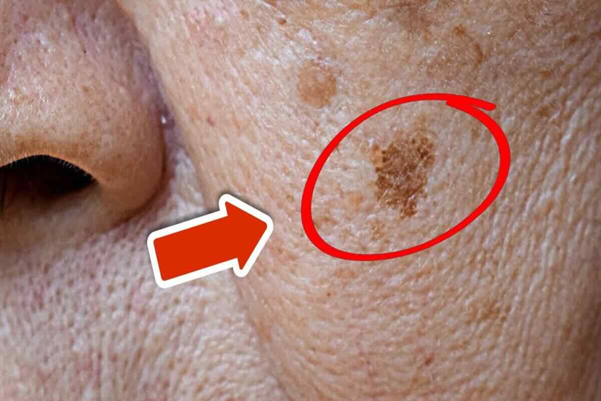 Il miglior alleato contro le macchie dell’età: lo trovi in frigo