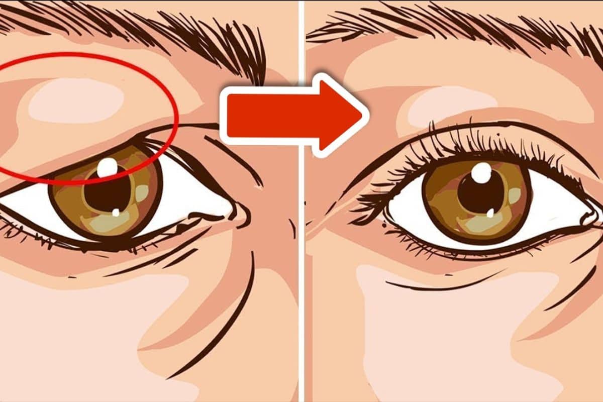 Palpebre cadenti, come disfarsene in pochi giorni: l’antico metodo