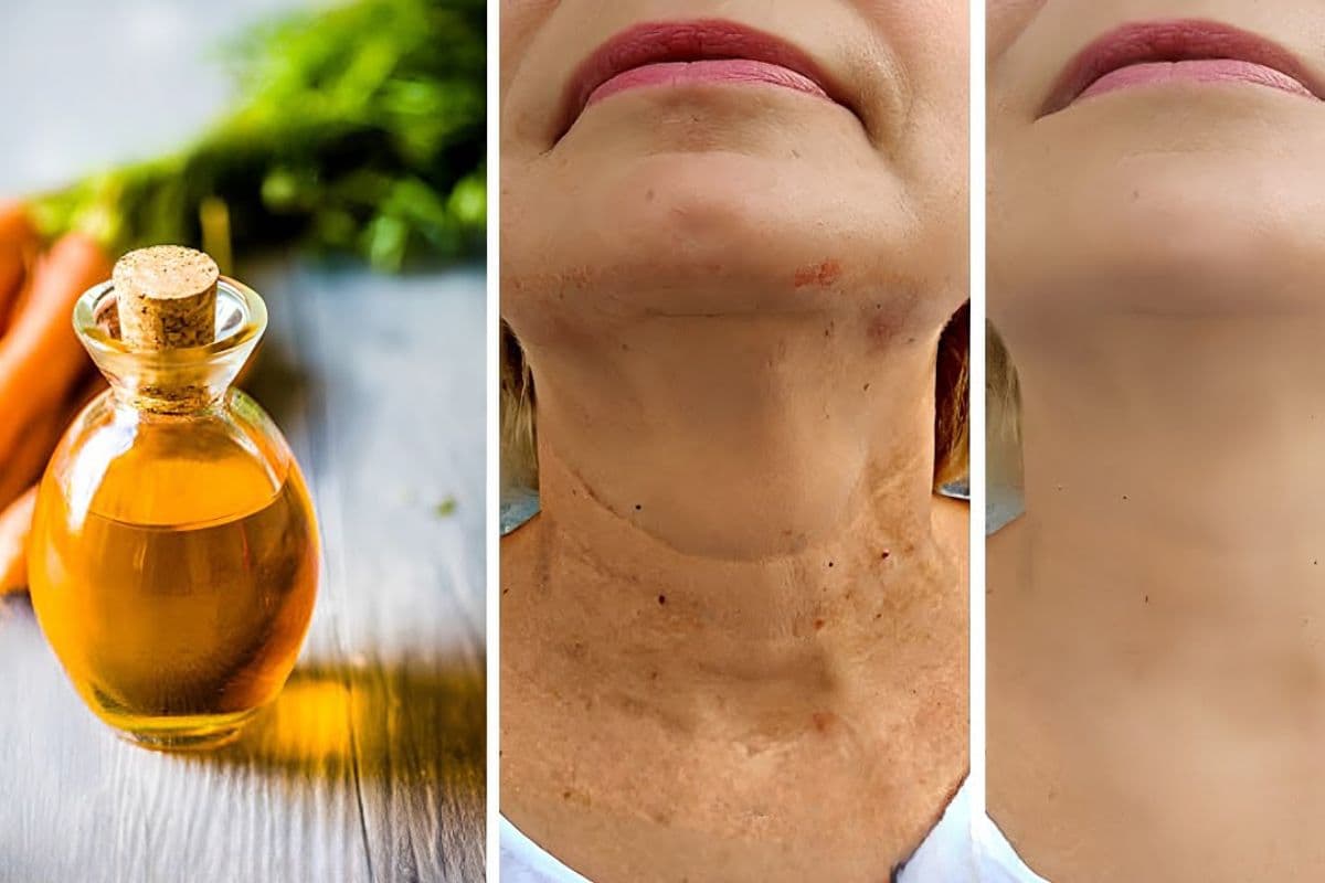 Collo pieno di rughe? Se non sai come disfartene, ecco la soluzione per te