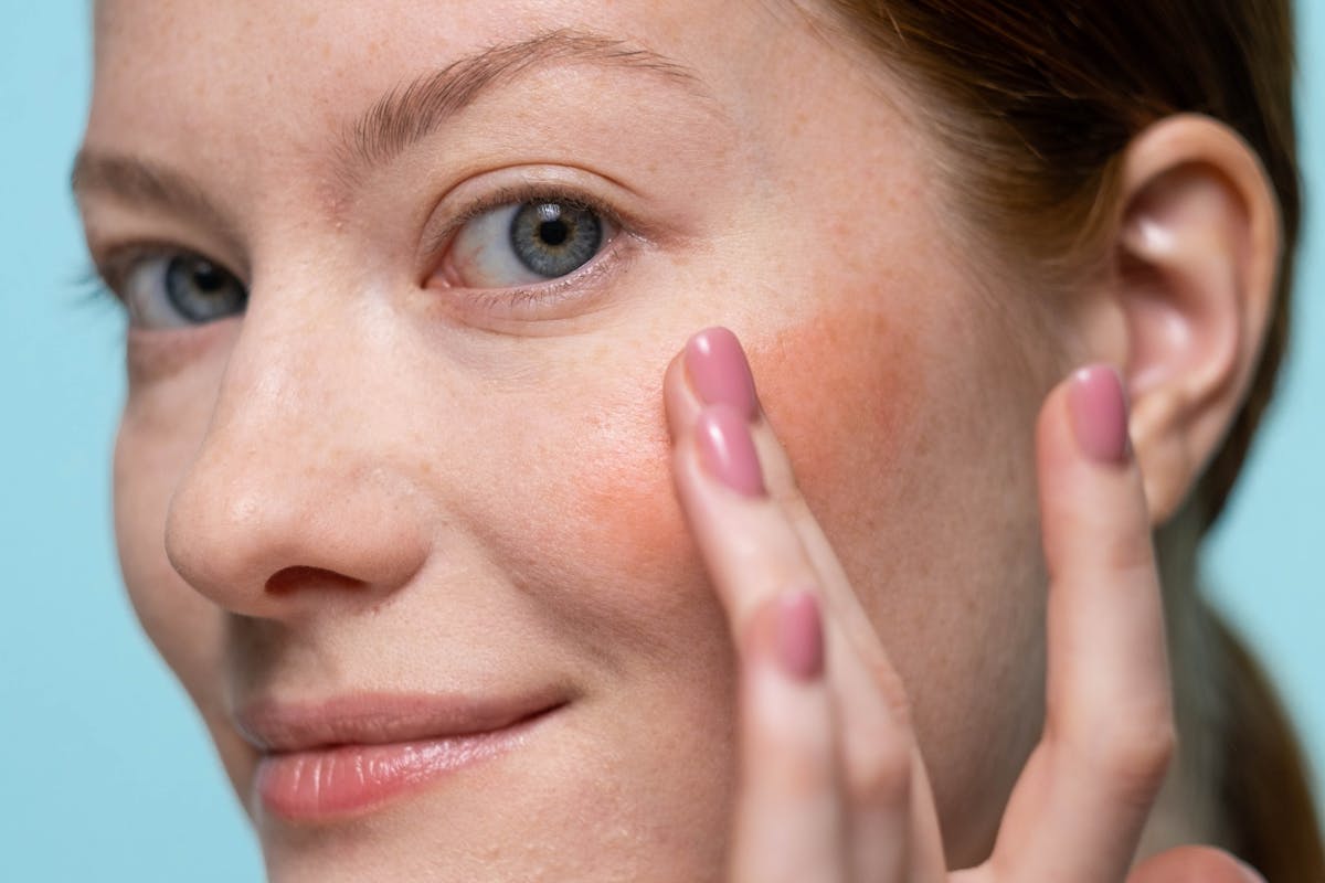 donna con viso rosso